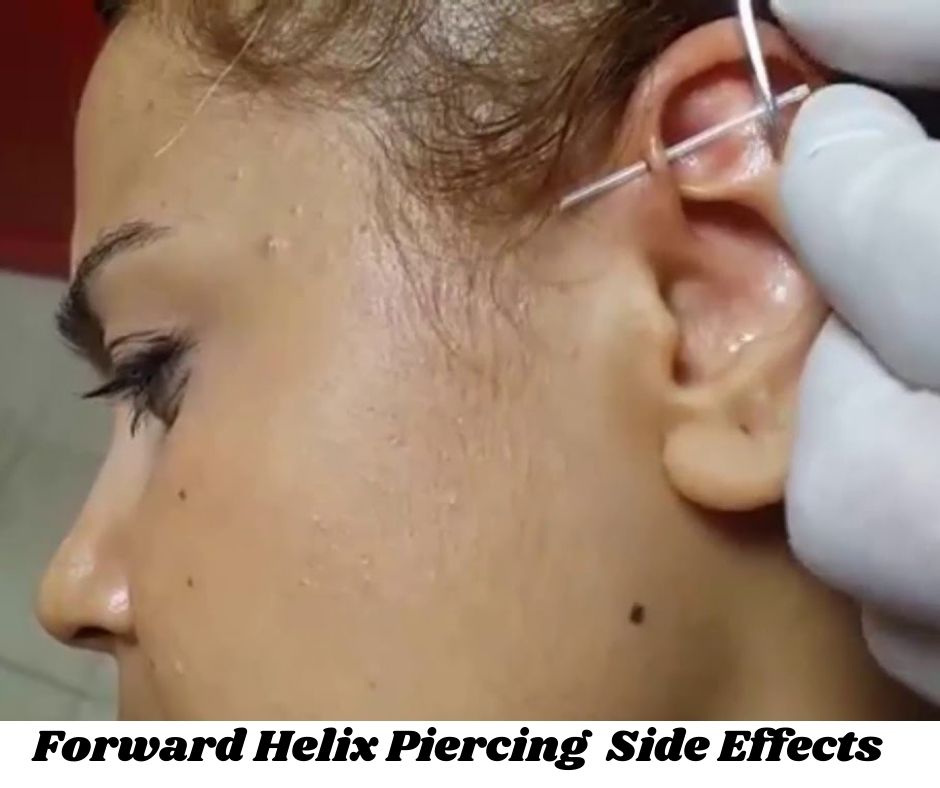 Forward Helix Piercing Side Effects